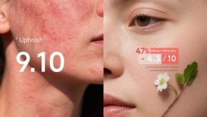 일광 화상 피부 진정 핵심 성분: 센텔라 아시아티카 추출물